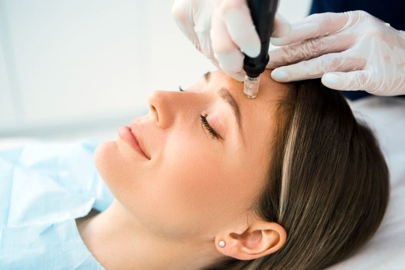 Woman receiving a microneedling with a device on a white background